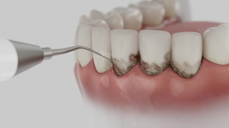 Trusted Dental Implants service in Talahi Island, GA - Dentist Open Now
